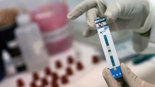 Logran reducir el VIH en seis pacientes a través de trasplantes de células madre en España