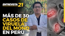 Infectólogo Juan Celis: Se reportan más de 30 casos de viruela del mono