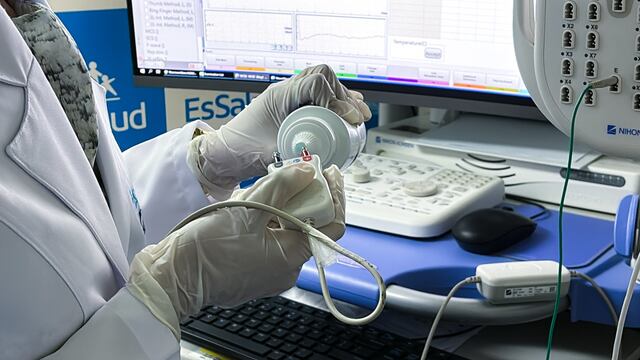 Hospital Grau ya cuenta con equipos biomédicos para repotenciar atenciones neurológicas y servicio de farmacia