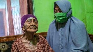 ¡Superó el coronavirus! Mujer de 100 años ganó batalla al COVID-19 en Indonesia