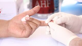 Pandemia de COVID-19 redujo en 55% detección de casos de VIH en población peruana