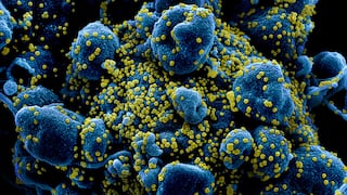 Mira cómo el coronavirus ataca las células humanas [FOTOS]