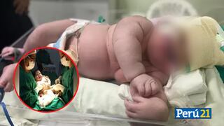 Brasil: nace bebé gigante de 7 kilos que sorprende a los medios