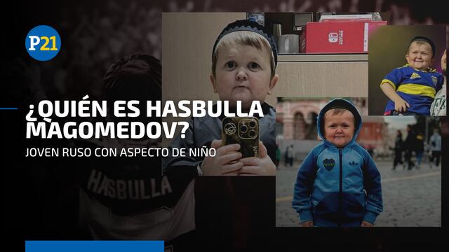 Quién es Hasbulla: el adulto con aspecto de niño que causó revuelo en Argentina