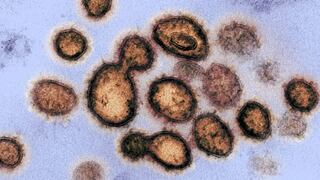 Coronavirus: Científicos chinos descubren cómo el virus infecta a las personas 