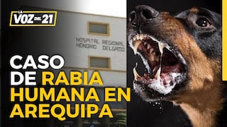 Walther Oporto sobre caso de rabia humana en Arequipa: “Ha sufrido una descompensación y está en UCI”