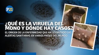 Viruela del mono: lo que se sabe hasta el momento de esta extraña enfermedad