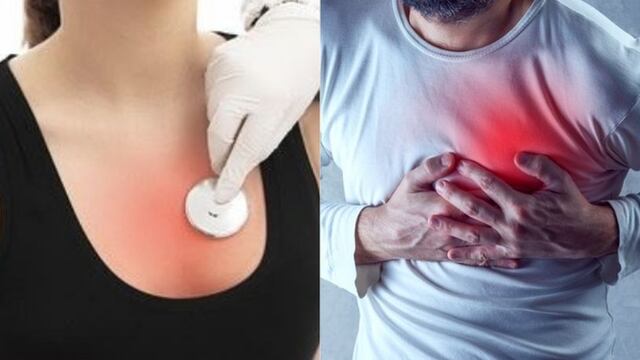 ¿Cuáles son los síntomas del infarto en hombres y mujeres?