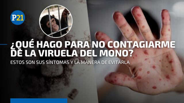 Viruela del mono en Perú: ¿Qué es y cómo evito contagiarme de esta enfermedad?