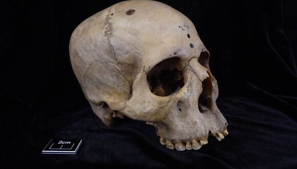 Cráneo y mandíbula 236. (Tondini, Isidro, Camarós, 2024).