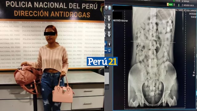 Capturan a joven que intentaba viajar a España con droga en su estómago | VIDEO
