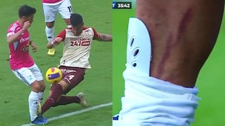 Alonso y la fuerte infracción contra Sosa en el Sporting Cristal vs. Universitario por la Liga 1 2022