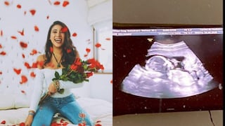 Samahara Lobatón cuenta detalles de su embarazo: “Estábamos asustados, no sabíamos cómo reaccionar”
