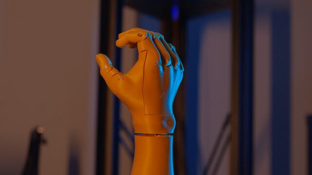 Pasco: Universitario recibe la primera prótesis biónica robótica de antebrazo y mano derecha
