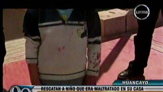Huancayo: Le rompe la cabeza a su hijo por no hacer la tarea