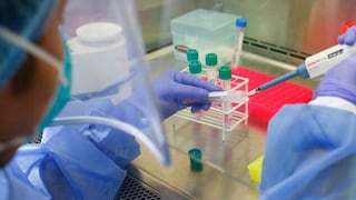 Laboratorio de EsSalud Junín entregará pruebas moleculares COVID-19 en menos de 24 horas