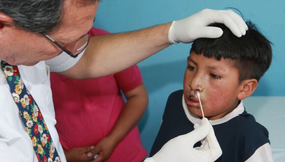 Aproximadamente nacen 2 mil 500 niños con labio leporino cada año, según informó el director de INSN Breña, Jaime Taysaco. (Foto: Andina)