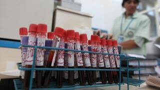 Alerta en Iquitos por transfusiones de sangre inseguras