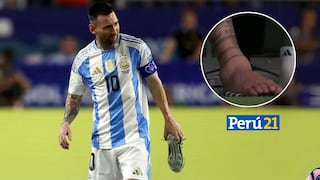 Messi se lesionó y salió en llanto: así le quedó su tobillo | VIDEOS