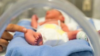 El nacimiento de un bebé sin rostro produce escándalo de negligencia en Portugal