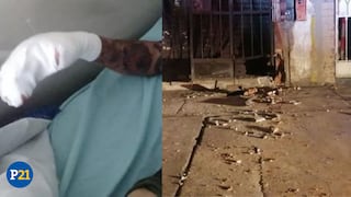Huánuco: Acusado de extorsión pierde los dedos de la mano al intentar detonar explosivo