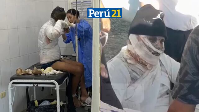 ¡Corre de dolor! Operario sufre quemaduras tras explosión de grifo flotante en Loreto | VIDEO 