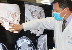 Médicos de EsSalud utilizan moderna tecnología para reconstruir maxilares sin dejar cicatrices