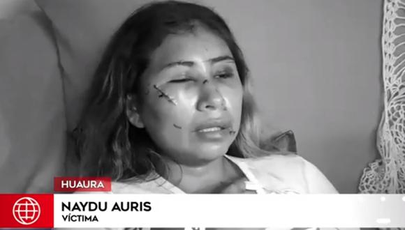 Naydú Auris fue atacada por su expareja y resultó con cortes en la cara y las piernas. (Foto: Captura América Noticias)