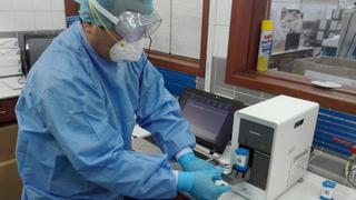 Cusco: Logran reducir a 3 horas el tiempo para resultados de pruebas moleculares COVID-19 