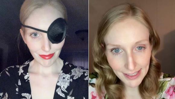 Shana Oakley tomó con humor lo que le ocurrió y tras más de 1 mes recuperó la vista de su ojo izquierdo. | Foto: @shanaoakley91