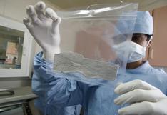 Hospital de EE.UU. dona piel humana para salvar vida de niño en INSN de San Borja