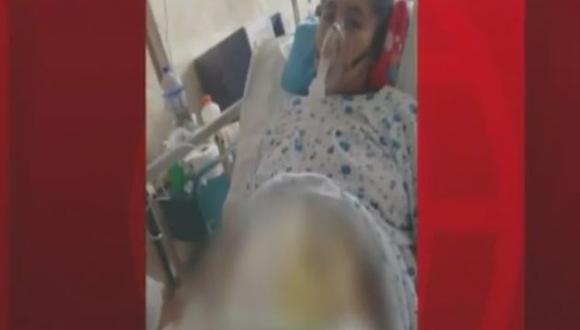 Hospital Sergio Bernales de Collique suspende a médicos por dejar gasa dentro del cuerpo de un paciente. (AméricaTV)