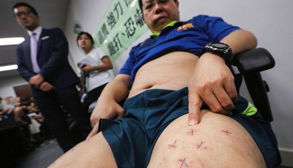 El activista Howard Lam denunció que agentes de seguridad chinos le engraparon las piernas por querer enviar foto de Lionel Messi a la viuda de Nobel de la Paz Liu Xiaobo. (AFP)