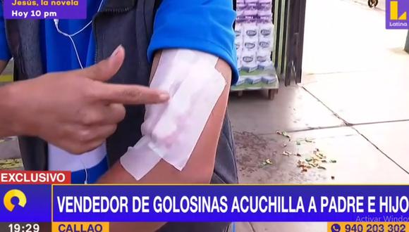 Jorge Torres muestra las heridas que le causó el vendedor de golosinas. (Latina)
