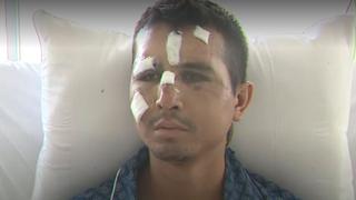 Policía herido en Andahuaylas: “fuimos atacados con piedras, hondas, jebes y una granada”
