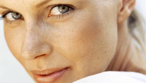 ¿Manchas faciales? Cinco tratamientos que te ayudarán a prevenirlas o atenuarlas