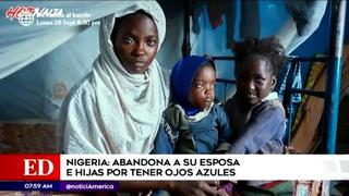 Nigeria: hombre abandonó a su esposa e hijas porque tienen ojos azules