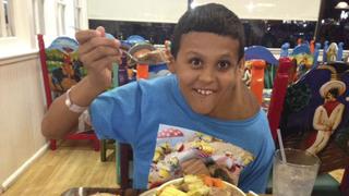Estados Unidos: Extirparon tumor a niño mexicano de 11 años