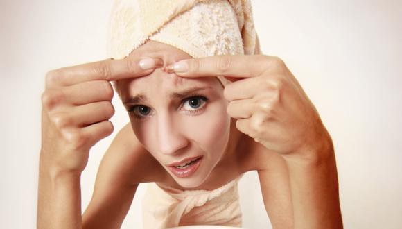 La aparición de acné en mujeres adultas suele estar relacionado con problemas ginecológicos. (USI)