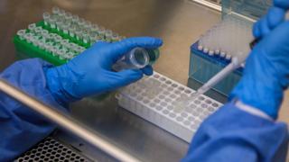 Coronavirus: “No tendremos una vacuna disponible antes de un año”, alertó especialista [VIDEO]