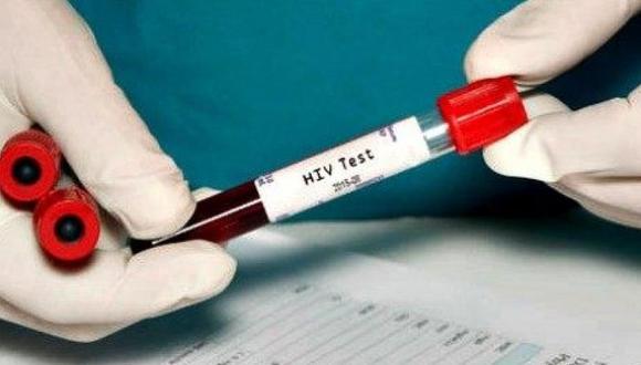 Según Abbott, se ha demotrado que el nivel de eficacia de esta autoprueba alcanza un 99,9%. “CheckNOW™ HIV Self-Test se utilizó en evaluaciones clínicas realizadas por profesionales de la salud. (Foto: AP)